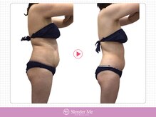 スレンダーミー 甲府本店(Slender Me)/ダイエット実績