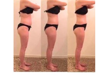 ヒーリングサプリ(Healing Supple)の写真