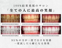 ホワイトニングショップ 長崎店