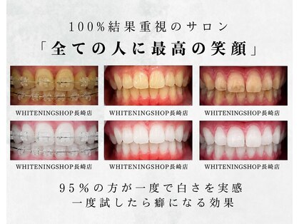 ホワイトニングショップ 長崎店の写真