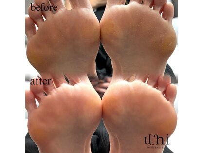 ユニ ビューティー アンド ネイルサロン(uni.Beauty&Nail salon)の写真