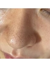 レイ(Rei)/毛穴が気になる方は絶対コレ！