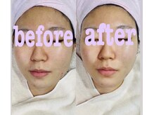 サロン ド ニューユー アンド エレナ 三島店(Salon de NEW YOU and Elena)の雰囲気（お肌のお悩みに合わせたフェイシャルでマイナス若見え肌）