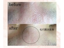 シェリール(cherir)/毛穴開きにも効果あり◎