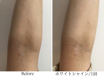 ビボーラ(BEBEAURA)/ホワイトシャイン☆