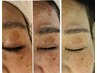 《40代からの透明肌ケア》シミ・くすみ集中美白フェイシャル【初回体験】
