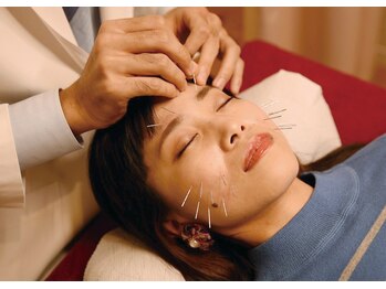 さくら鍼灸整骨院の写真/人気の美容鍼はお試しあり◎。実力派の鍼灸院で東洋学に基づくケアを始めてみませんか？