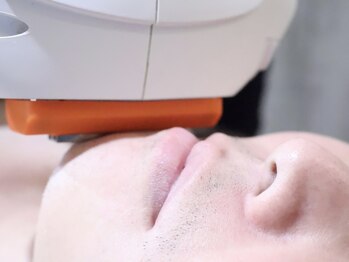 脱毛メリーの写真/初めての方にもおすすめ★脱毛+毛穴洗浄で艶肌が手に入る？！男性の毛のお悩みはお任せ下さい！