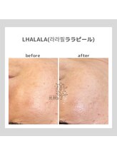 ポムハヌル(pom.haneul)/韓国肌管理室