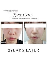 ハグミー 甲子園口(HUGME.)/小顔/トーンup/たるみケア/美肌