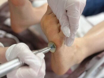 クランベリーネイル 所沢駅前店(cranberry nail)/フットの角質ケア