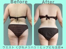 ビーナイス ビューティー(Be Nice Beauty)/背中★ハミ肉！スッキリ☆