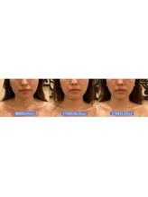 アジール 長岡リバーサイド千秋店(agir)/Before/After画像