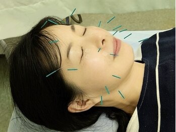 辻鍼灸接骨院の写真/【鍼灸施術が初めての方も◎】国家資格保有スタッフが施術☆幅広い女性に人気！仕事や育児で忙しい方にも◎