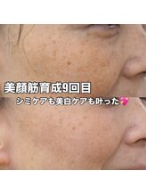 リエル(RIEL)/【美顔筋育成】