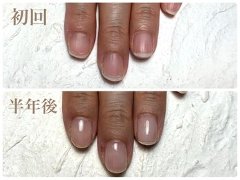ビビネイル(vivi.NAIL)/自爪育成