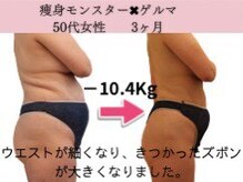 ファニービー 茨木本店/Before→After