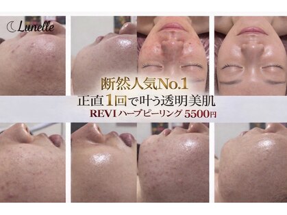 ルネル(Lunelle)の写真