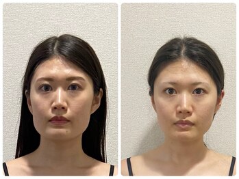 シエル(CIEL)/【驚愕】四角い顔が三角に