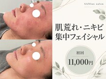 サンラックスサロン 岐阜(SANlux Salon)