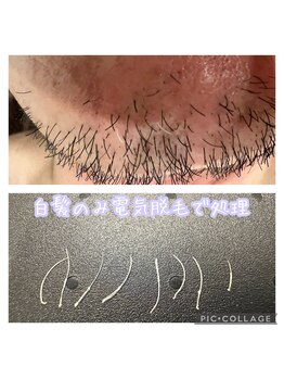 サロン ド ソレイユ(Salon.de.Soleil)/髭の白髪のみすべて処理