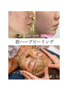 ミナミ/オススメコレです！