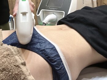 99 バイ デコ 小樽(99 by DeCo)/デリケートゾーンの脱毛