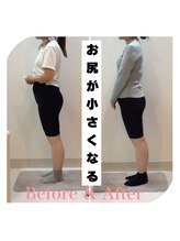 スタイルラボ高松/骨盤矯正の効果♪