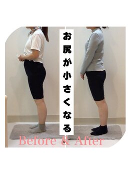 スタイルラボ高松/骨盤矯正の効果♪