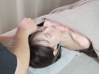 いこい鍼灸院 整骨院 小倉院/穏やかに整える自律神経鍼灸