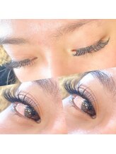 ニコ(nico)/【バインドロック】140本