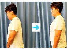 いのくち接骨院/姿勢改善の症例