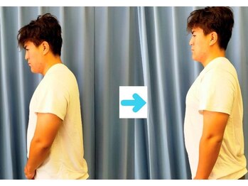 いのくち接骨院/姿勢改善の症例