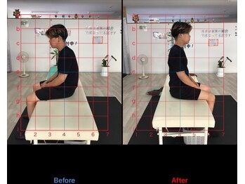 ストレチックス 近江八幡店/ストレッチ ビフォーアフター