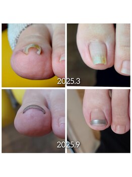 爪切り屋 足楽/