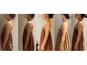 ロココ 豊田店(Rococo)/ビフォーアフター