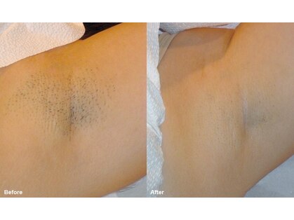 エクラ(e'clat)の写真