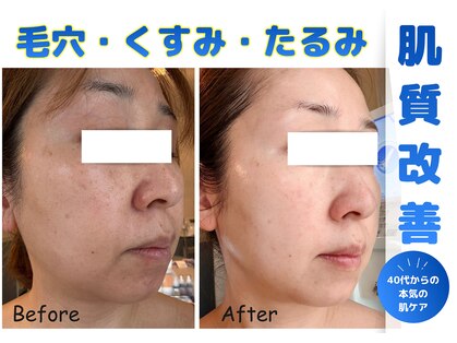リアン(Rian)の写真