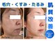 リアン(Rian)の写真