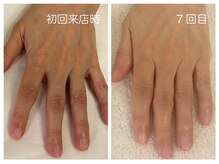 キレイテ 上野店/50代/7回目【ハンドケア上野】