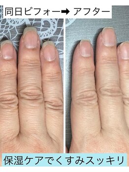 桃の木 吉祥寺店/ハンドケア&ネイルケア