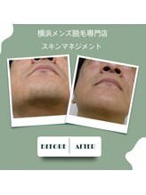 スキンマネジメント 横浜/Before &After