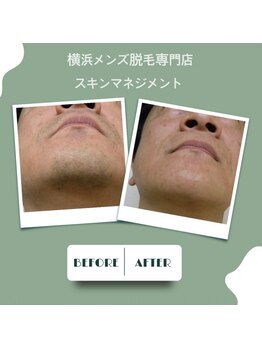 スキンマネジメント 横浜/Before &After