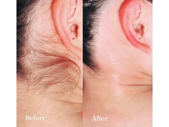 サーラ(SA-RA)/えり足ワックス