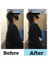 フォーユー鍼灸整骨院 津久野院(for you 鍼灸整骨院)/首の可動域への施術２