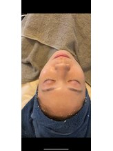 ベルフィーヌ(belfine)/3 &nbsp;セルマンピーリング剤塗布