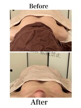 ハリムーン 仙台(harimoon)/ブライダル