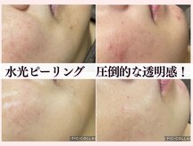 ミレット(Miretto)