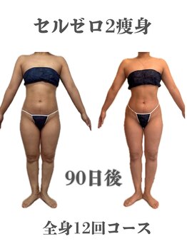 リミー(Re:Me)/30代〇〇さんの変化/全身