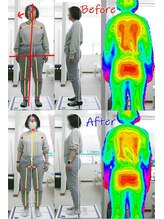 姫路なごみ整体院 なごみ鍼灸院/（改善例）慢性肩こり・首・不眠